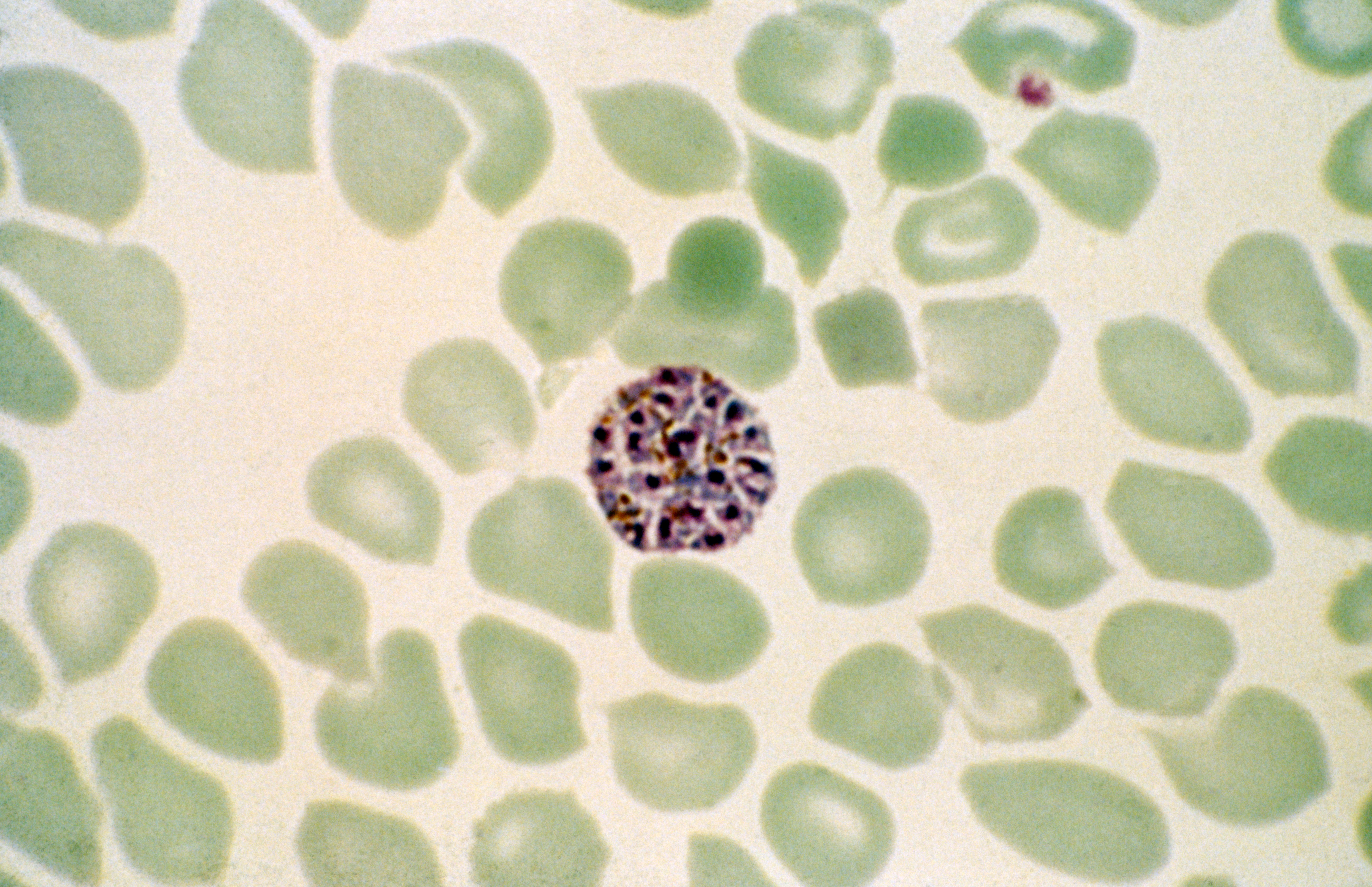 Wel plasmodium_vivax-credit_jr_baker-cc